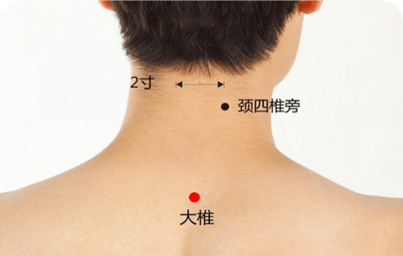 大椎穴